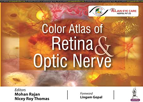 Color Atlas of Retina & Optic Nerve