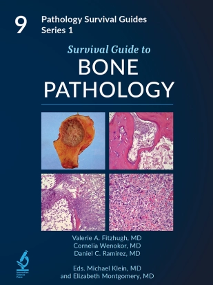 Survival Guide to Bone Pathology