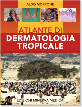 Atlante di Dermatologia Tropicale
