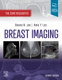 Breast Imaging, 4th Edition