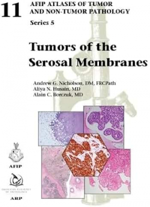 AFIP series 5 Fasc. 11- Tumors of Serosal Membranes