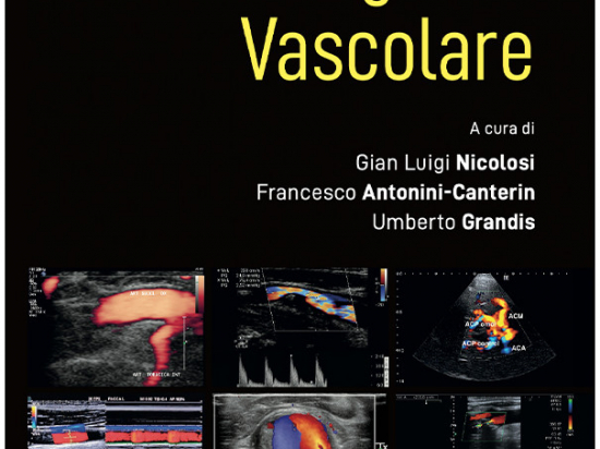 Ultrasonografia Vascolare