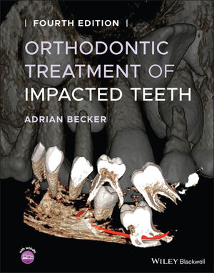 Orthodontic Treatment of Impacted Teeth, 4th Edition