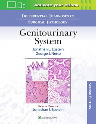 Differential Diagnoses in Surgical Pathology: Genitourinary System Second edition