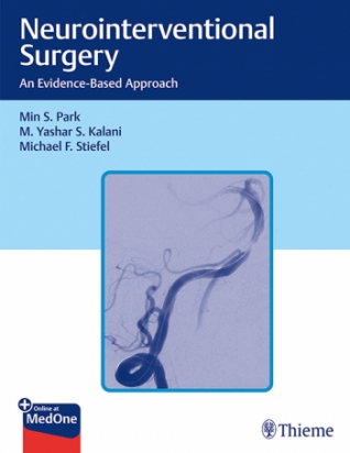 Neurointerventional Surgery