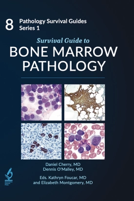 Survival Guide to Bone Marrow Pathology