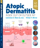 Atopic Dermatitis: Inside Out or Outside In