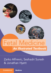 Fetal Medicine