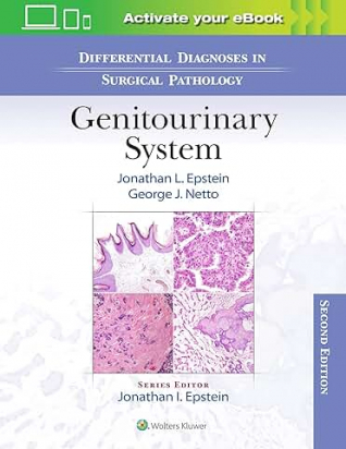 Differential Diagnoses in Surgical Pathology: Genitourinary System Second edition
