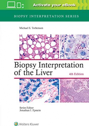 Biopsy Interpretation of the Liver Fourth edition