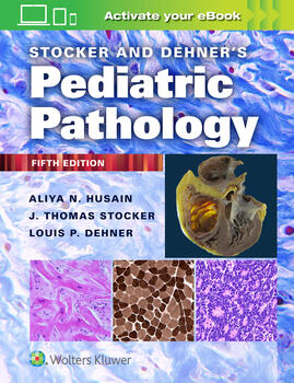 Stocker and Dehner's Pediatric Pathology 5th edition
