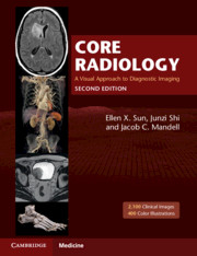 Core Radiology, 2nd Edition - 2 Volumes