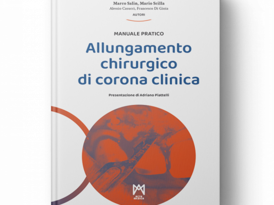 Allungamento Chirurgico di Corona Clinica