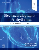 Electrocardiography of Arrhythmias: A Comprehensive Review, 2nd Edition