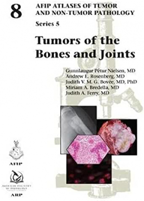 AFIP Series 5 Fasc. 8 - Tumors of the Bones and Joints