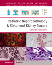 Pediatric Nephropathology & Childhood Kidney Tumors