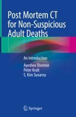 Post Mortem CT for Non-Suspicious Adult Deaths