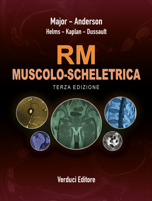 RM Muscolo-Scheletrica