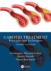 Carotid Treatment: Principles and Techniques - 3rd Edition