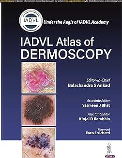 Atlas of Dermoscopy