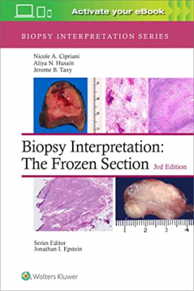 Biopsy Interpretation: The Frozen Section Third edition