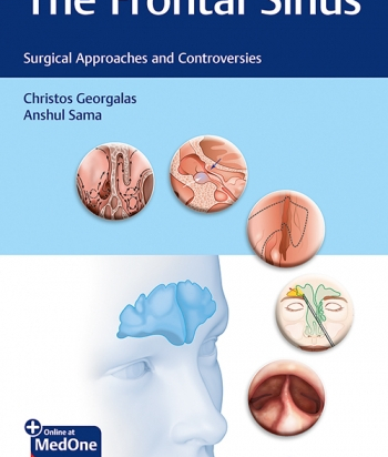 The Frontal Sinus