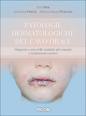 Patologie Dermatologiche del Cavo Orale