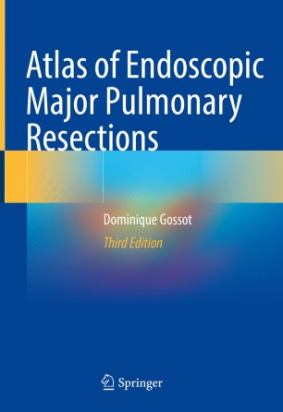 Atlas of Endoscopic Major Pulmonary Resections