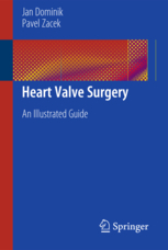 Heart Valve Surgery