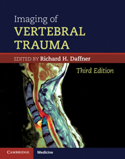 Imaging of Vertebral Trauma  3rd Edition