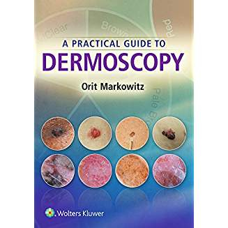 A Practical Guide to Dermoscopy 