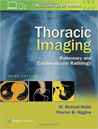 Thoracic Imaging, 3e 