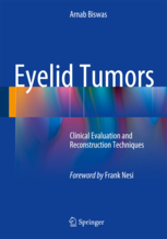 Eyelid Tumors