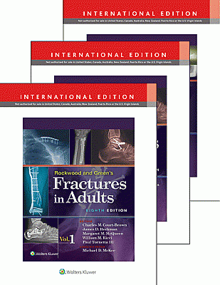 Rockwood, Green, and Wilkins' Fractures in Adults and Children International Package, 8e 