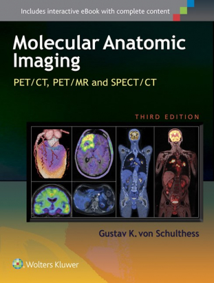 Molecular Anatomic Imaging 3rd ed