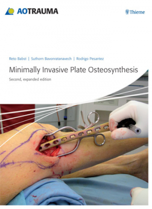 Minimally Invasive Plate Osteosynthesis (MIPO), 2nd Edition