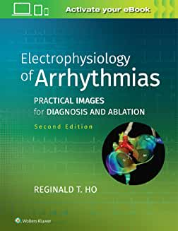 Electrophysiology of Arrhythmias, 2nd Edition