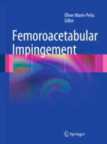 Femoroacetabular Impingement