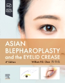 Asian Blepharoplasty and the Eyelid Crease 4th Edition