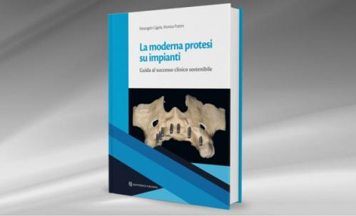 La moderna protesi su impianti