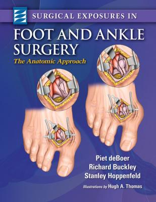 Surgical Exposures in Foot &amp; Ankle Surgery 