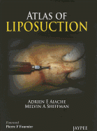 Atlas of Liposuction