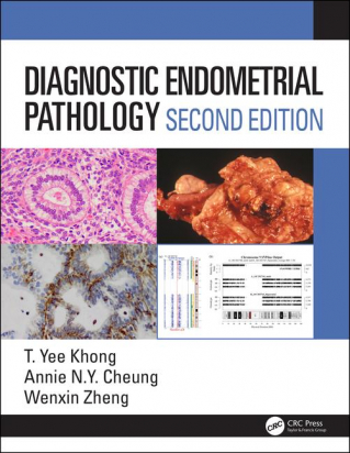 Diagnostic Endometrial Pathology  2nd Edition