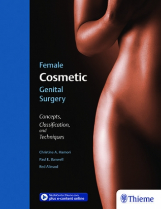 Female Cosmetic Genital Surgery