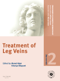 Treatment of Leg Veins, 2nd Edition