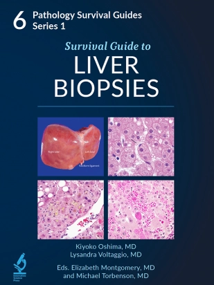 Survival Guide To Liver Biopsies