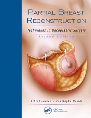 Partial Breast Reconstruction 2nd ed