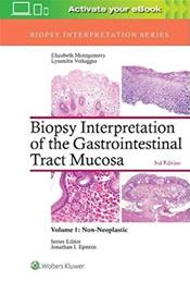 Biopsy Interpretation of the Gastrointestinal Tract Mucosa: Volume 1 - 3rd ed