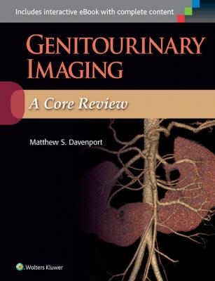 Genitourinary Imaging: A Core Review 