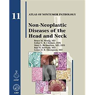 AFIP NonTumor  11 Non-Neoplastic Diseases of the Head and Neck